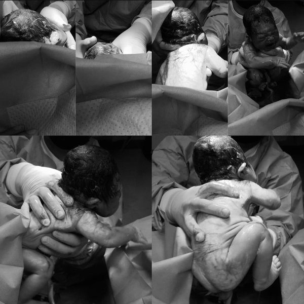 Nacimientos atendidos por Dr. Ariel Veces — Instagram post