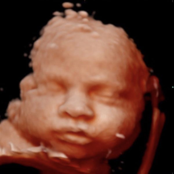Ultrasonido 4D mostrando rostro de bebé en gestación — Instagram post