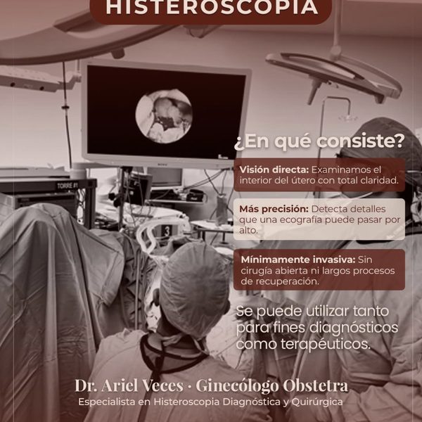 Post educativo sobre histeroscopia — Dr. Ariel Veces Instagram